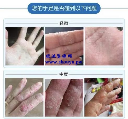 偏门项目:脱皮偏方赚钱术,抓住这波机会你也能小赚一笔!